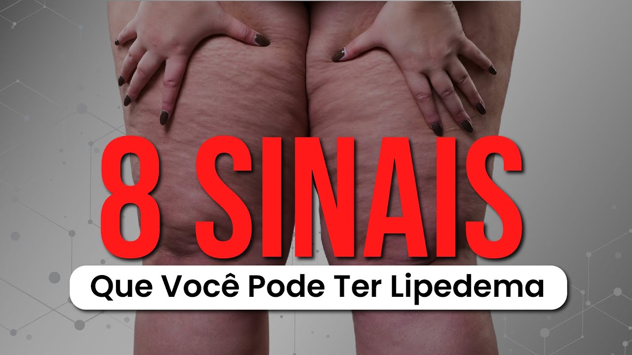 Lipedema: o que é? - ABL