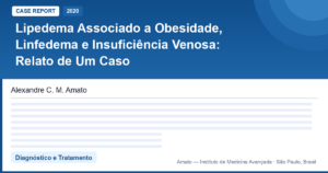 Lipedema + obesidade + linfedema + IVC: quando tudo se sobrepõe