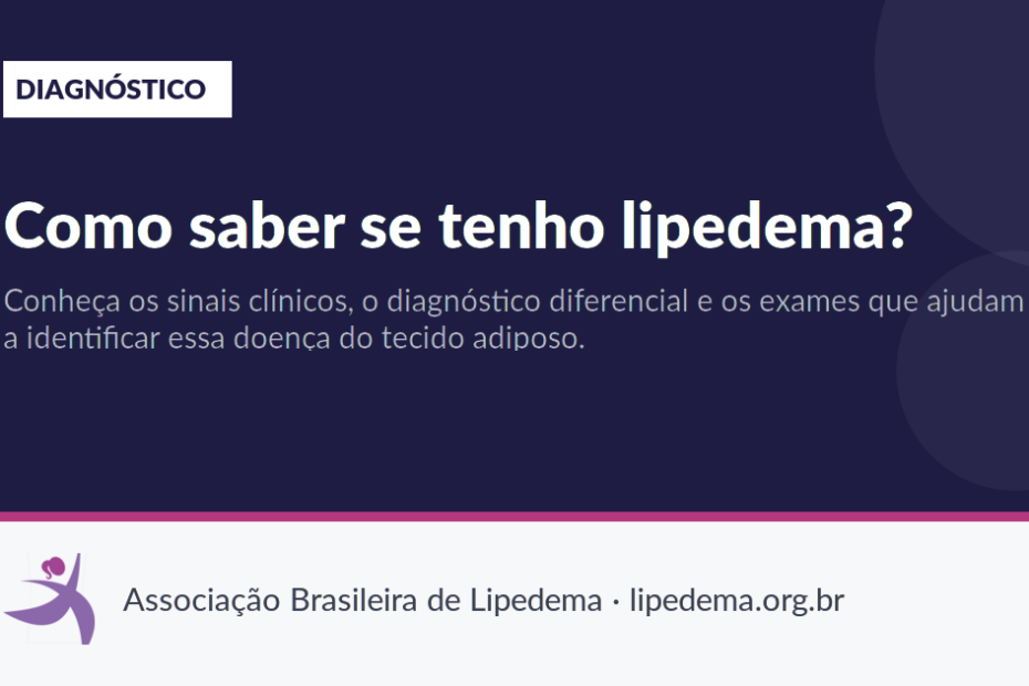 Como saber se tenho lipedema?