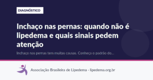 Inchaço nas pernas: quando não é lipedema e quais sinais pedem atenção
