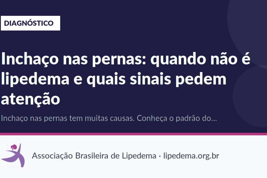 Inchaço nas pernas: quando não é lipedema e quais sinais pedem atenção