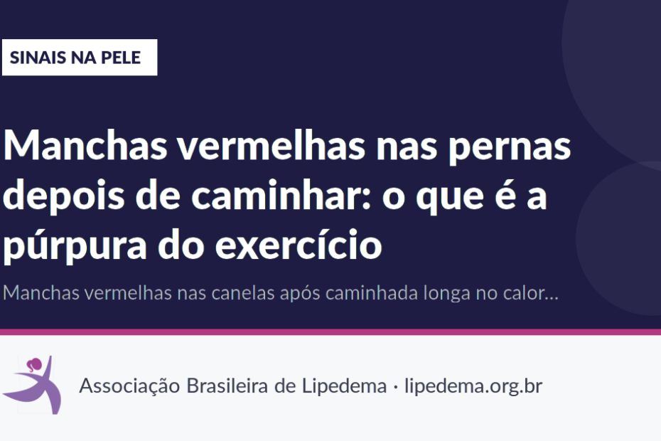 Manchas vermelhas nas pernas depois de caminhar: o que é a púrpura do exercício
